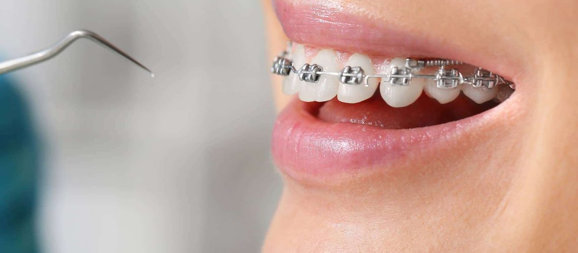 Te contamos cómo la ortodoncia puede ayudarte a tener una correcta pronunciación.