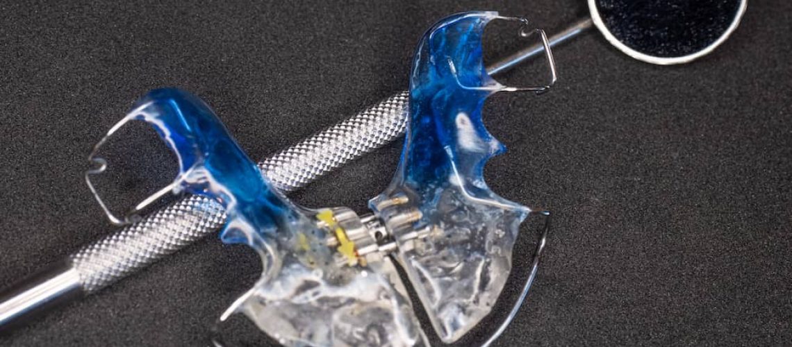 ortopedia-dentofacial Ortopedia dentofacial en Santiago de Compostela: beneficios e implicaciones.