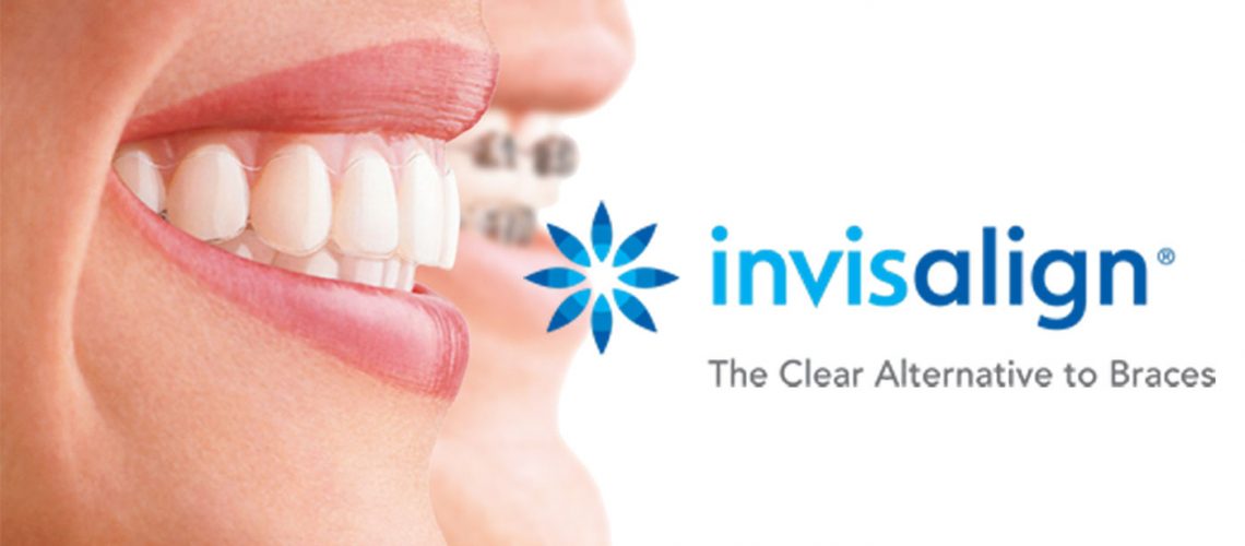 Cartel de Invisalign